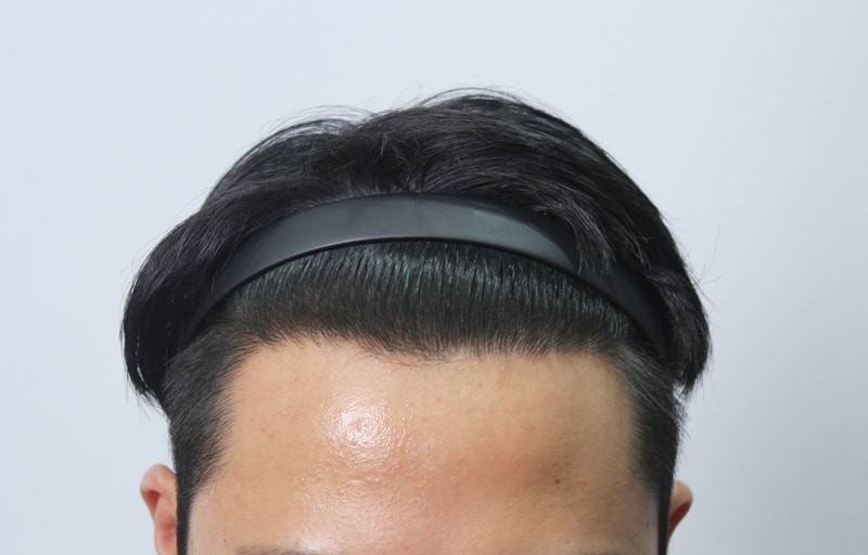 [모아트의원]ㅋㅋ아니 벌써 내가 벌써 1년이라니