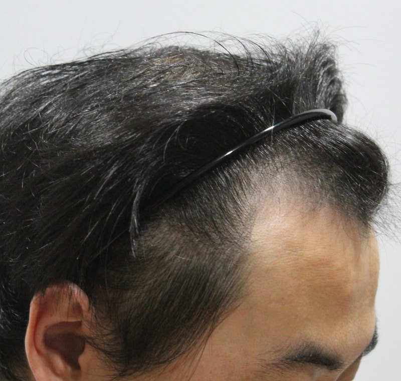 수술전 10.JPG