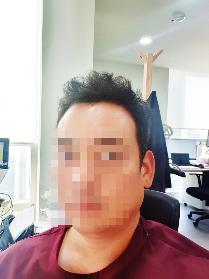 이수호 수술 후 6개월 -모자이크.jpg