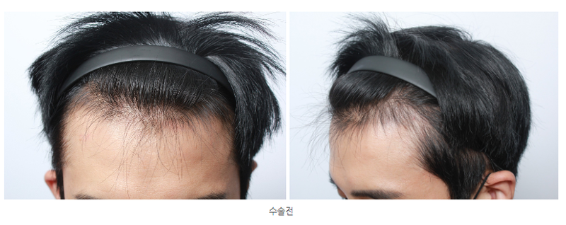 캡처01.PNG