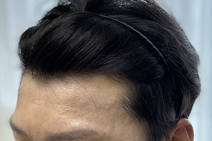 수술 후 3.jpg