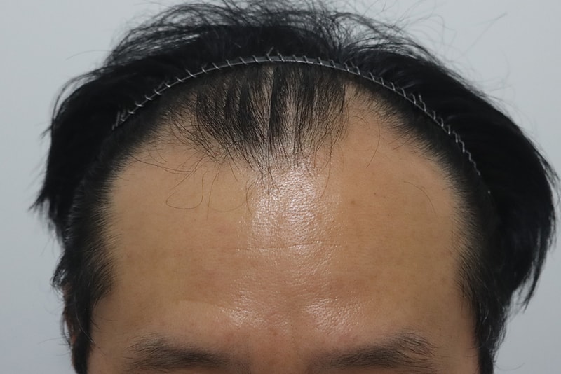 전.jpg
