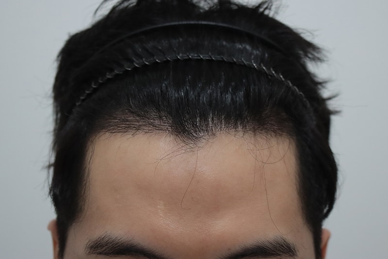 후 1.jpg