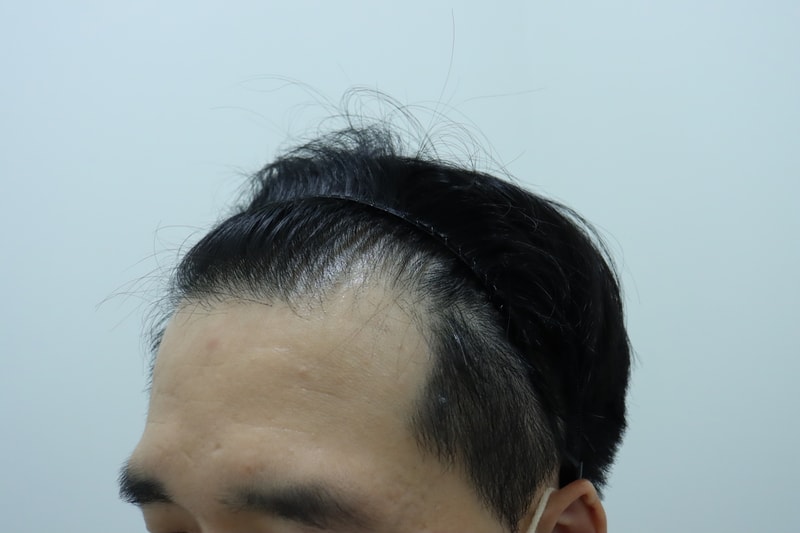 수술 전 2.JPG