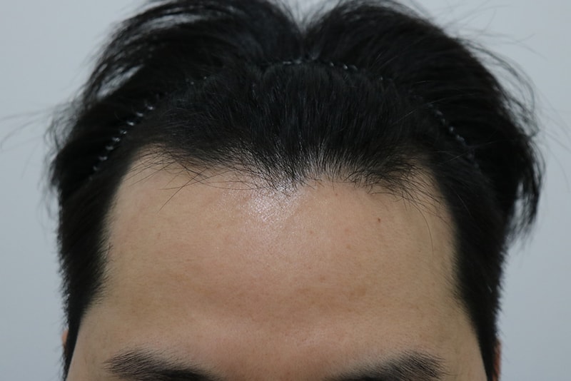 3400모 258일 지난 후기