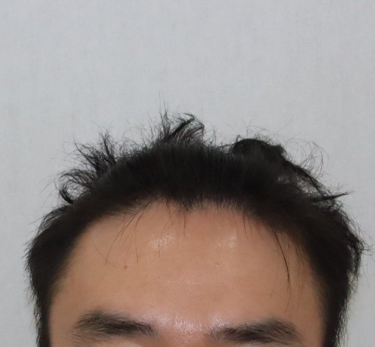 전 1.JPG