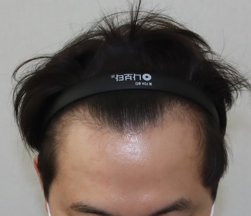 B 1.JPG