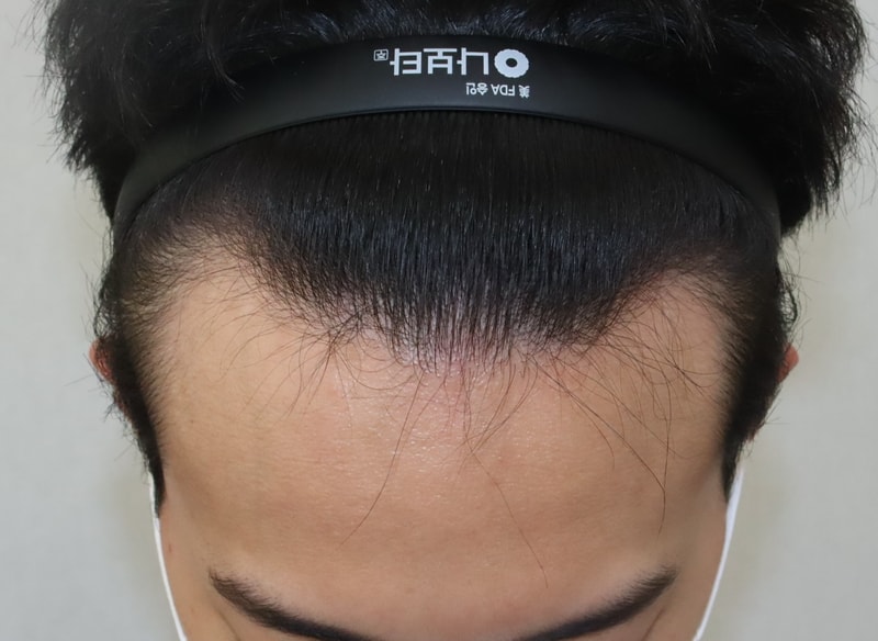 B 3.JPG