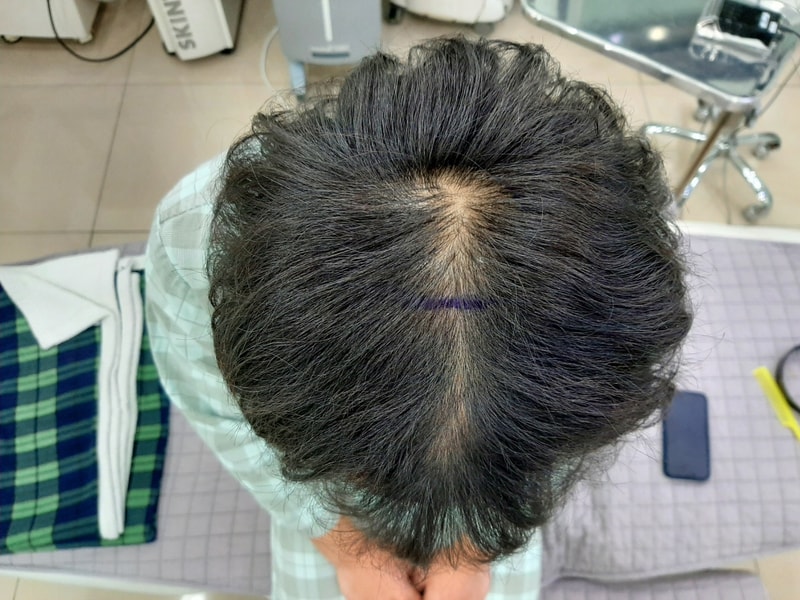 1.수술 전2.jpg