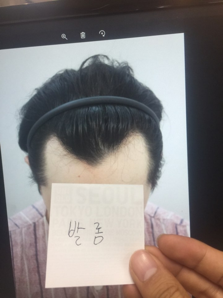 탈모극복! 포헤어