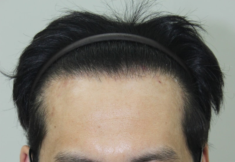 수술전.JPG