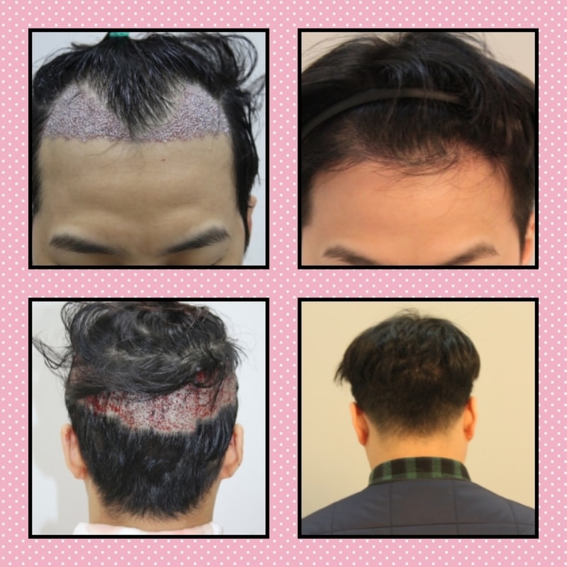 잘 자라고 있네요