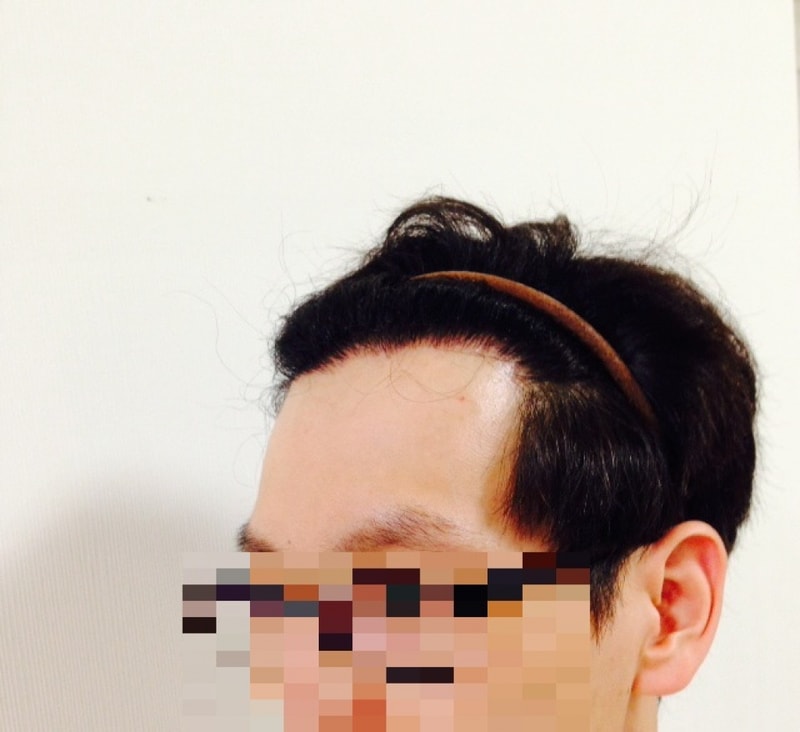 op좌.JPG