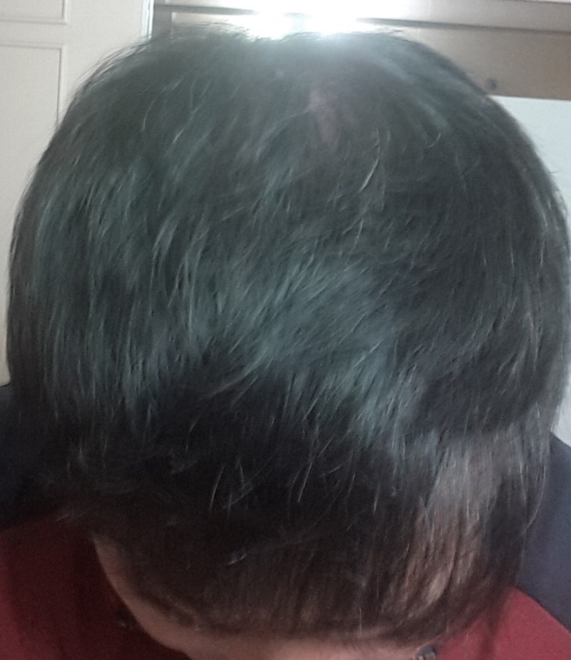 op20151109_194744.jpg
