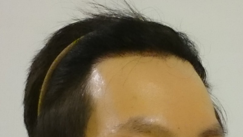 op우.JPG