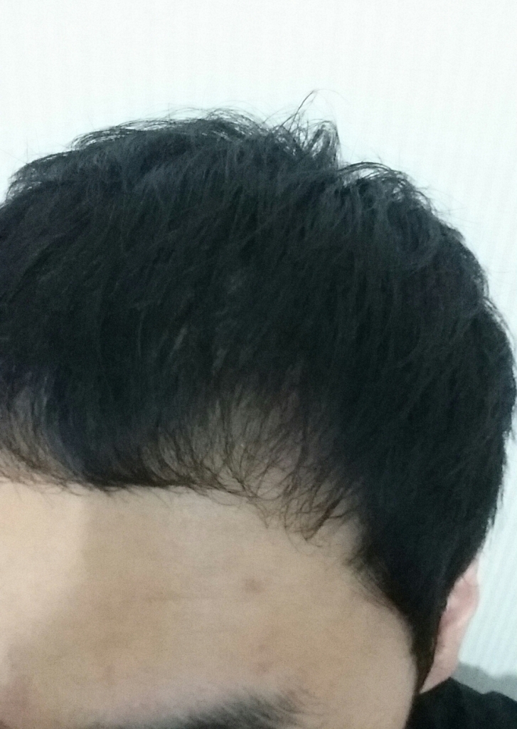 20150918_111824-1.jpg