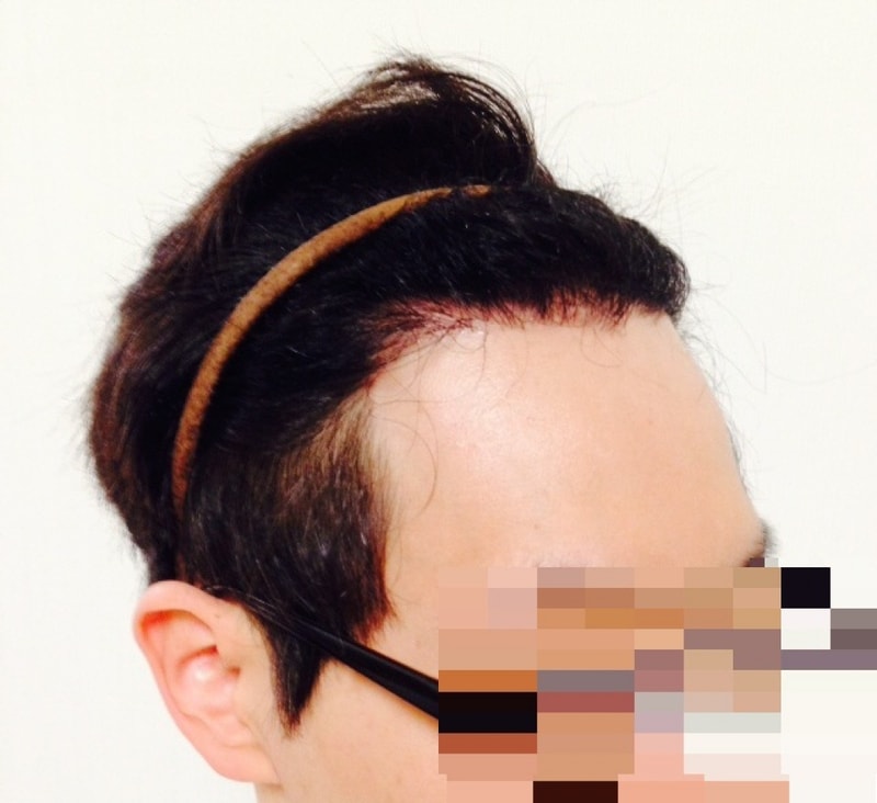 op우.JPG