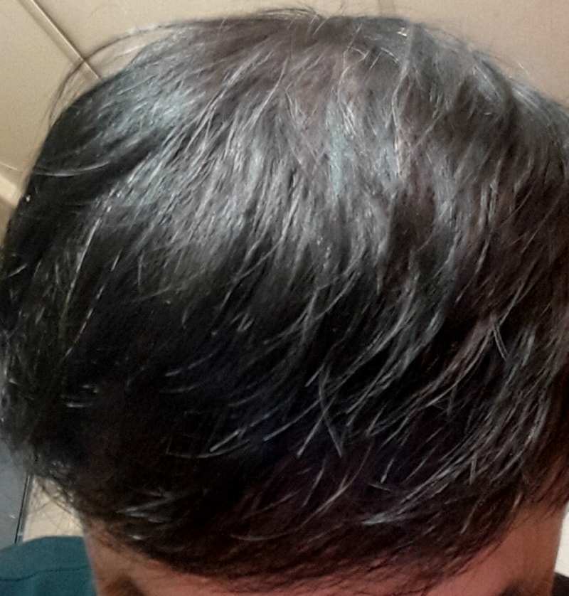 op20150809_084007.jpg