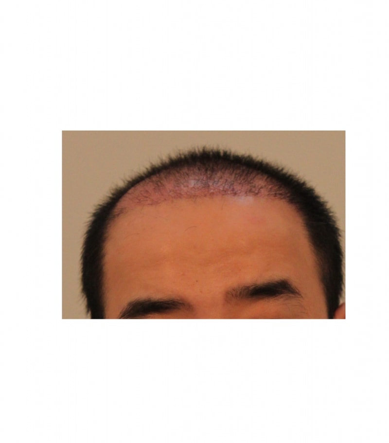 제목 없음.png