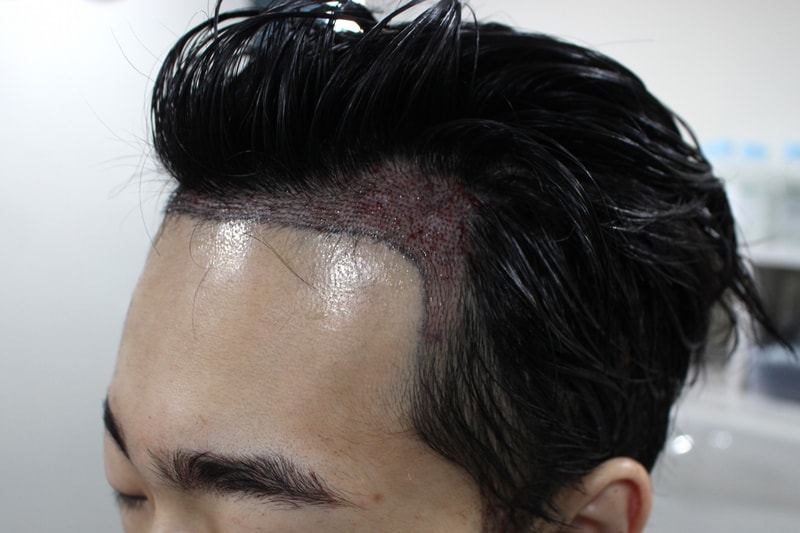 수술후2.jpg
