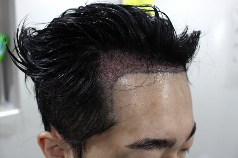 수술후3.jpg