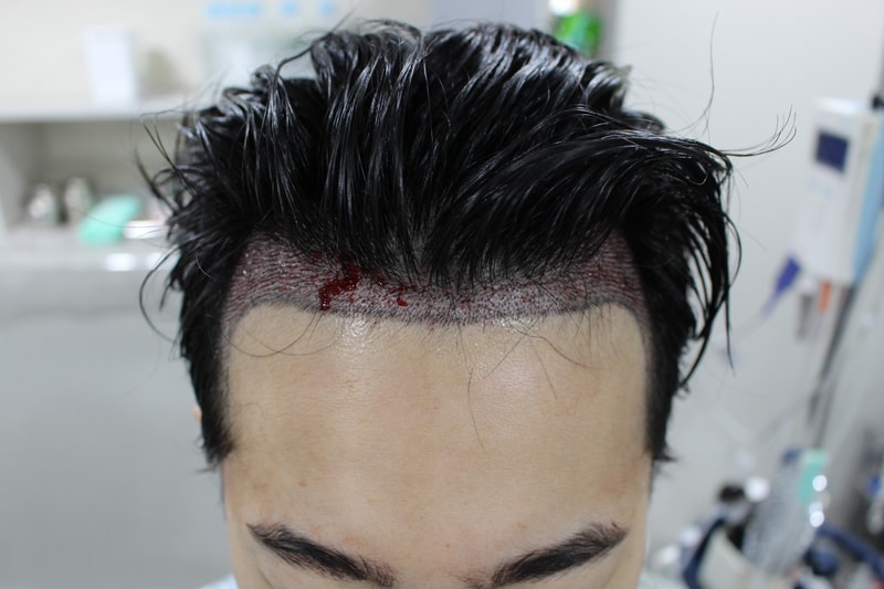 수술후4.jpg