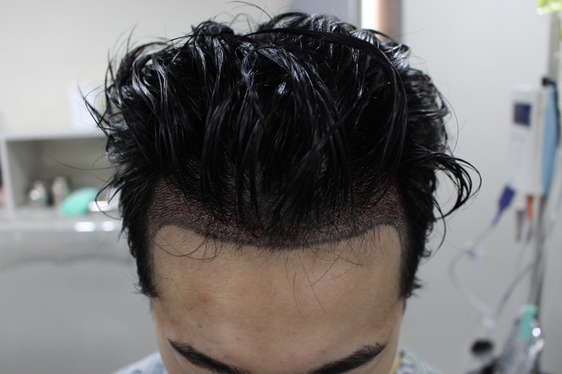 수술후1.jpg