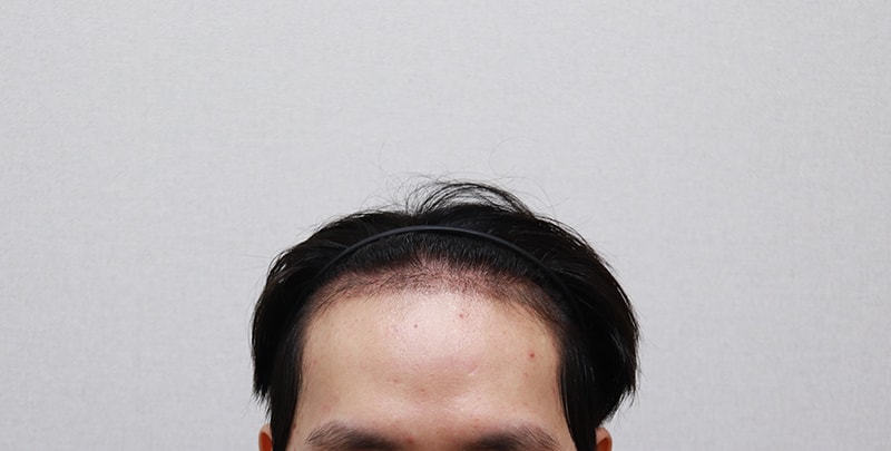 IMG_4564_3개월.JPG
