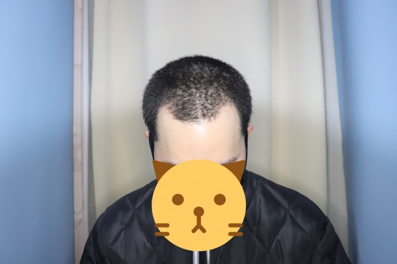 수술 전 사진.jpeg
