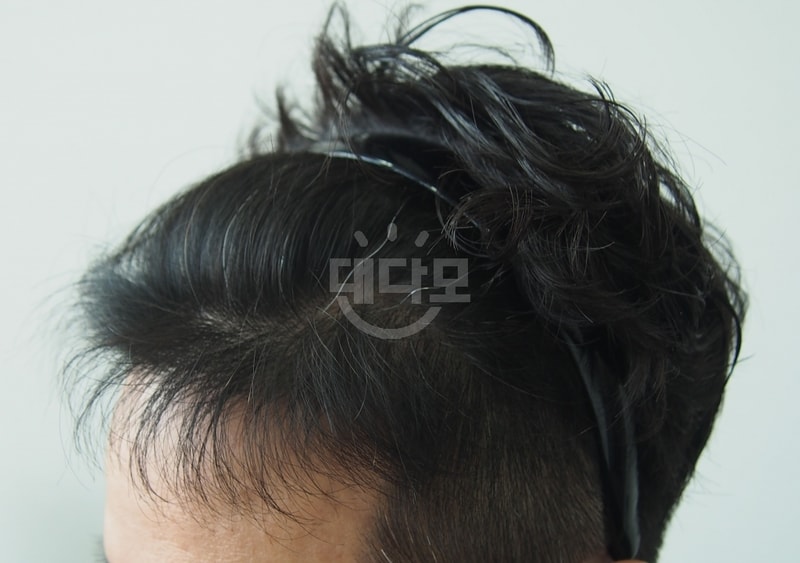 5개월 3.jpg
