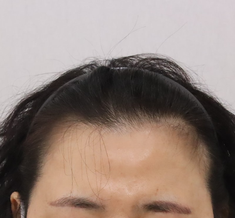 전.JPG