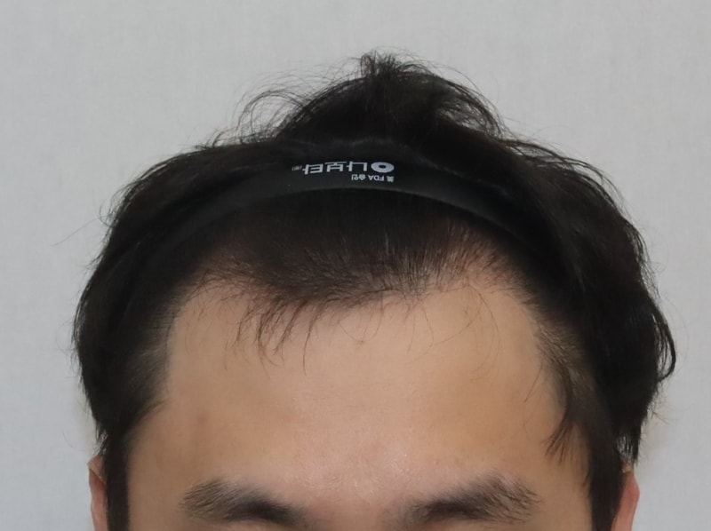 전 2.JPG