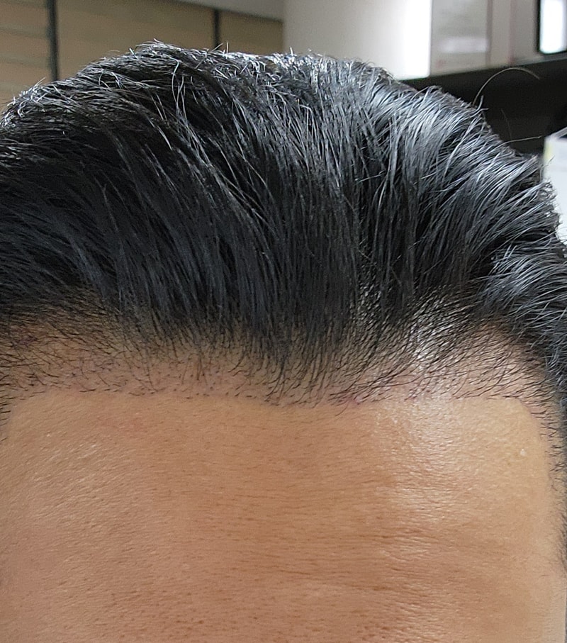 It's a 3-month review of the non-cut M shape.