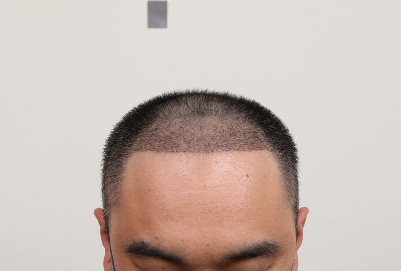 1000012614.jpg