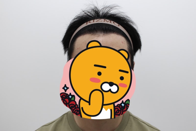 5번 후.jpg