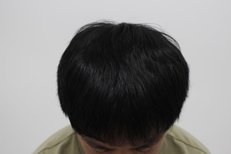 1번 후.jpg