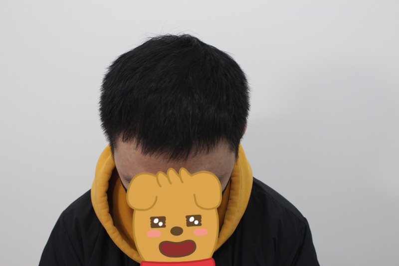 4개월 경과3.jpg