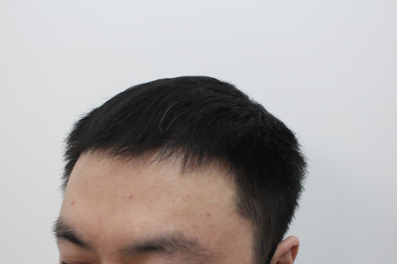 4개월 경과2.jpg
