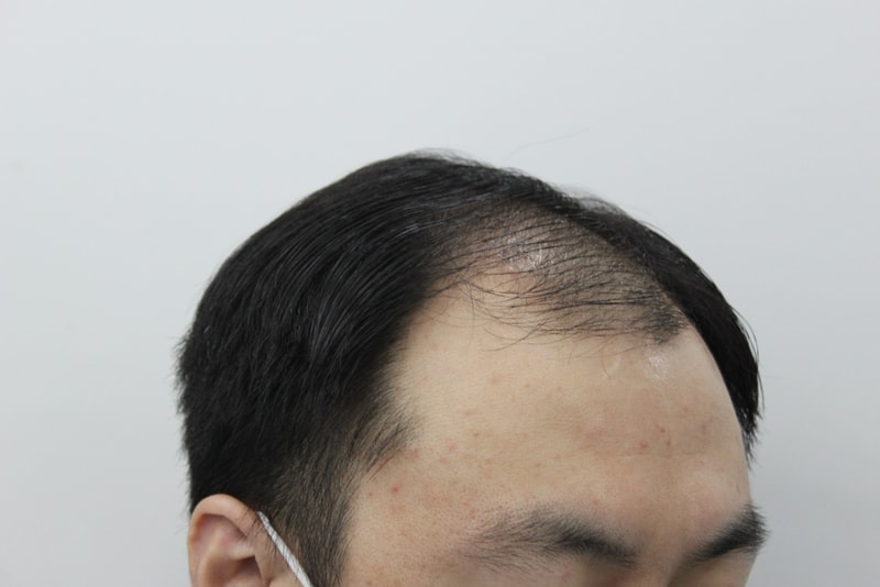 2번 전.jpg