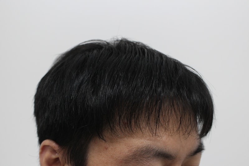 2번 후.jpg
