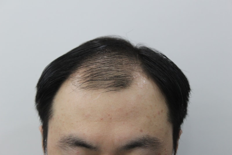5번 전.jpg