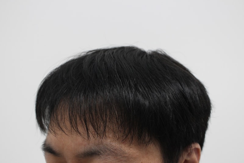 3번 후.jpg