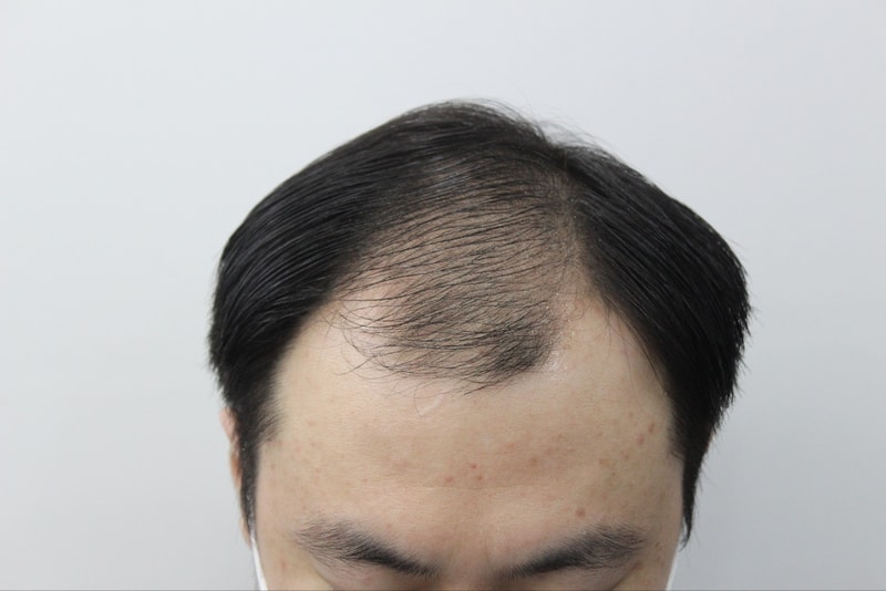 전 1.jpg