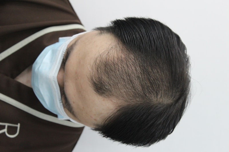 수술 전3.jpg