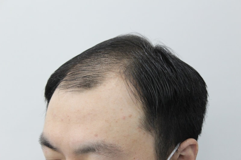 3번 전.jpg