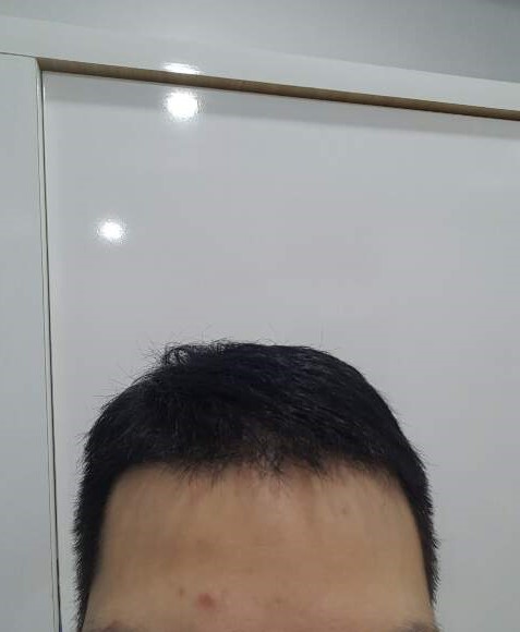 정면4개월차.jpg