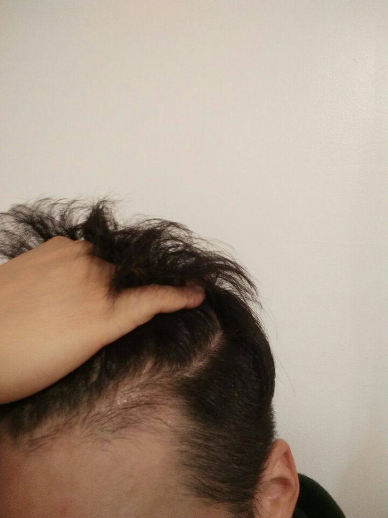 2달후1.jpg