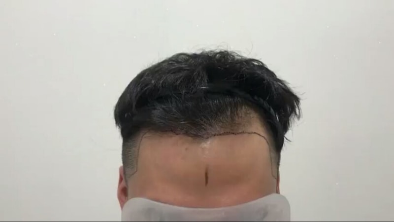 전.jpg