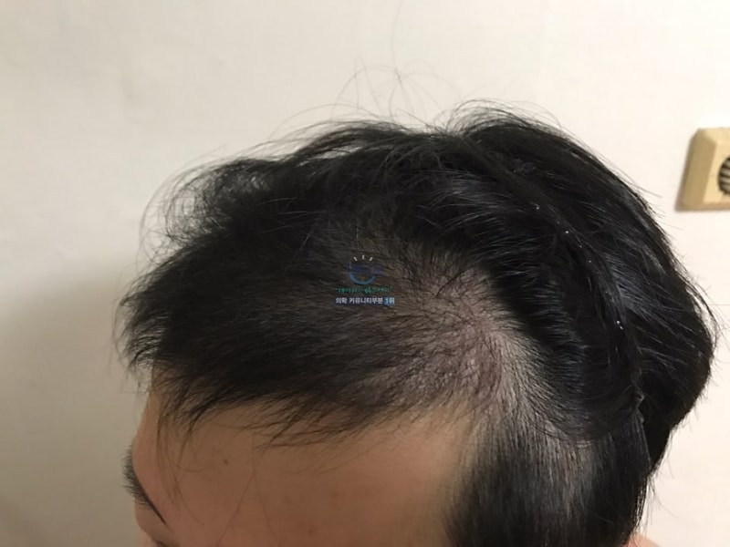 4개월.jpg