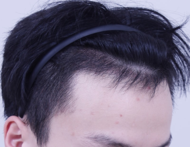 3개월 오른쪽.JPG